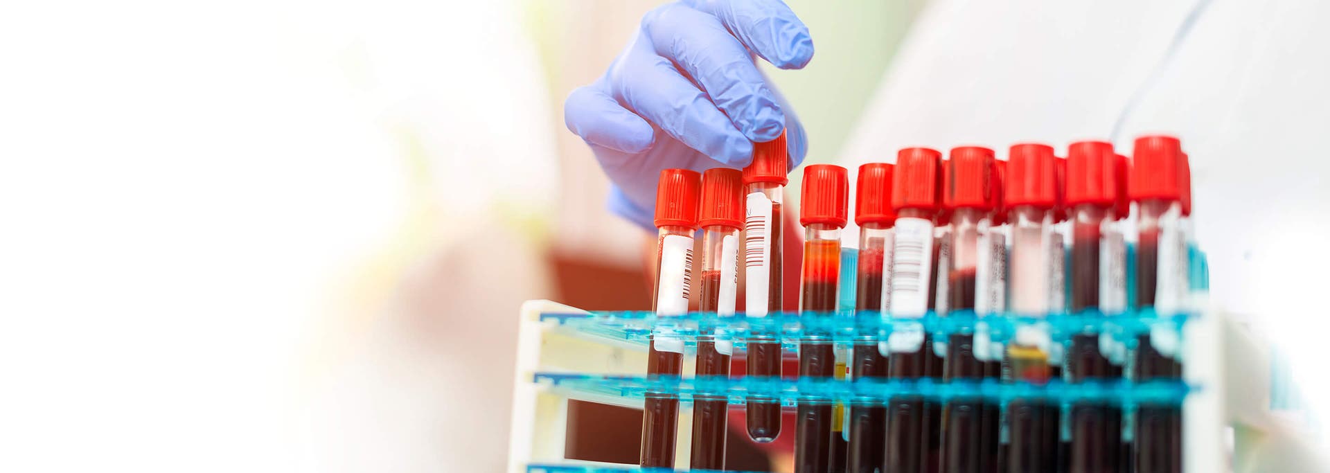 Comprehensive Multi-Drug Screening